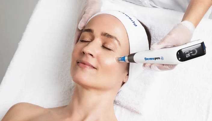 Microneedling with Dermapen treatment for skin renewal